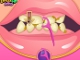 Bad Teeth Makeover